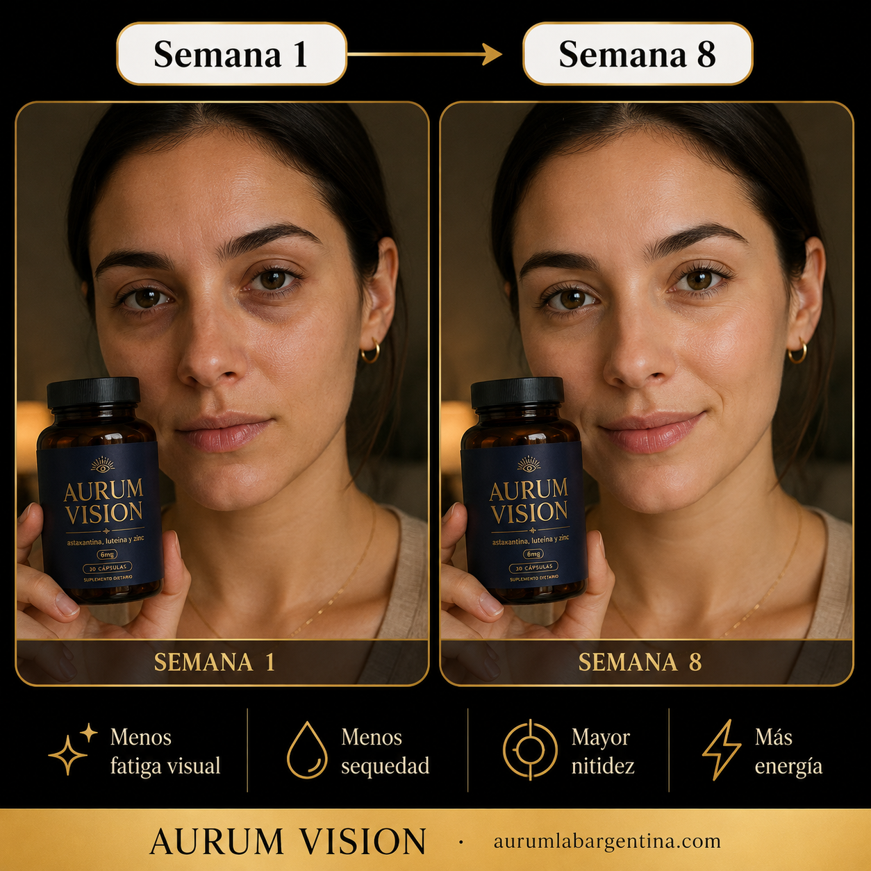 Aurum Vision