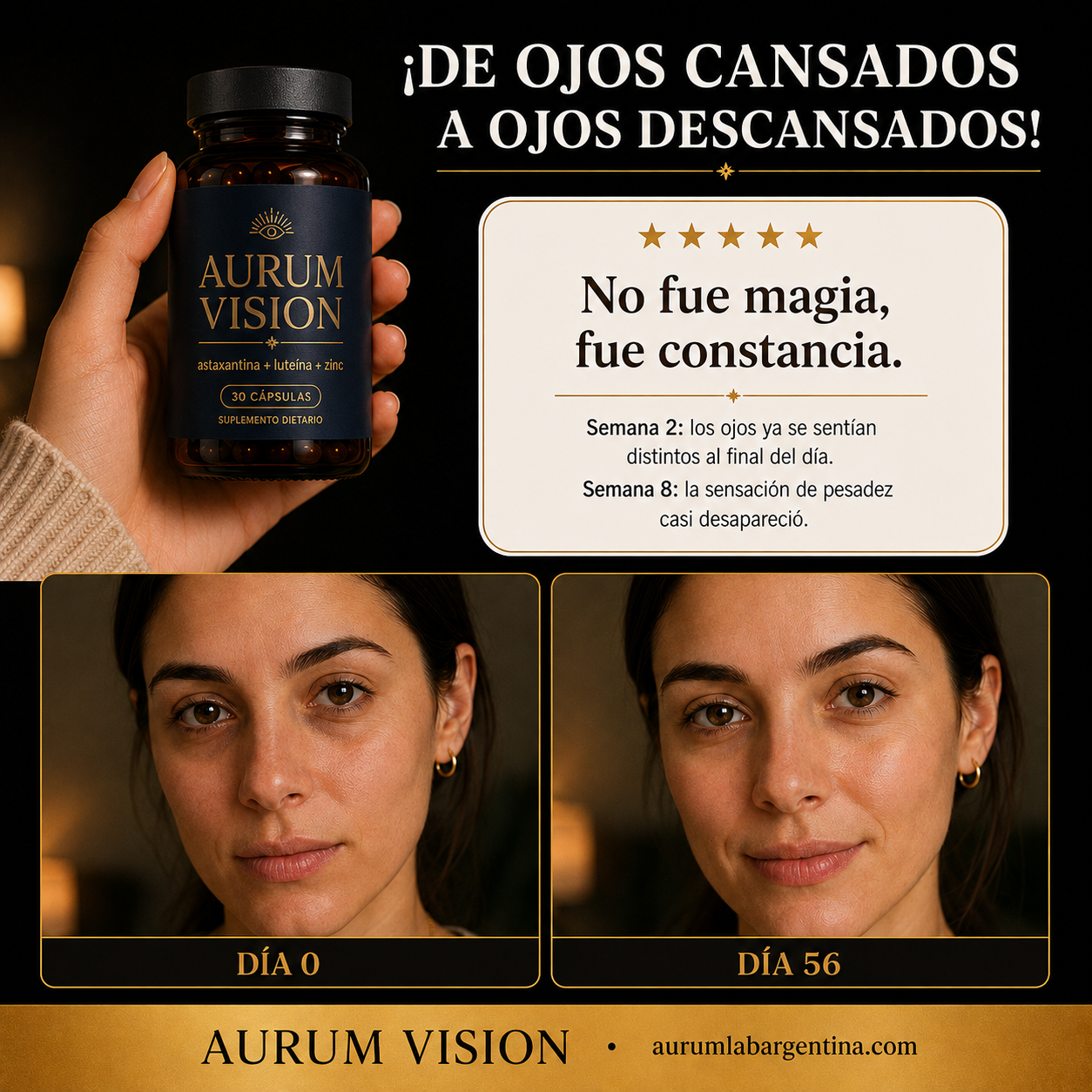 Aurum Vision