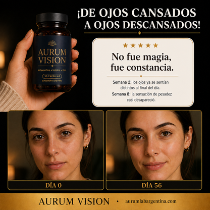 Aurum Vision